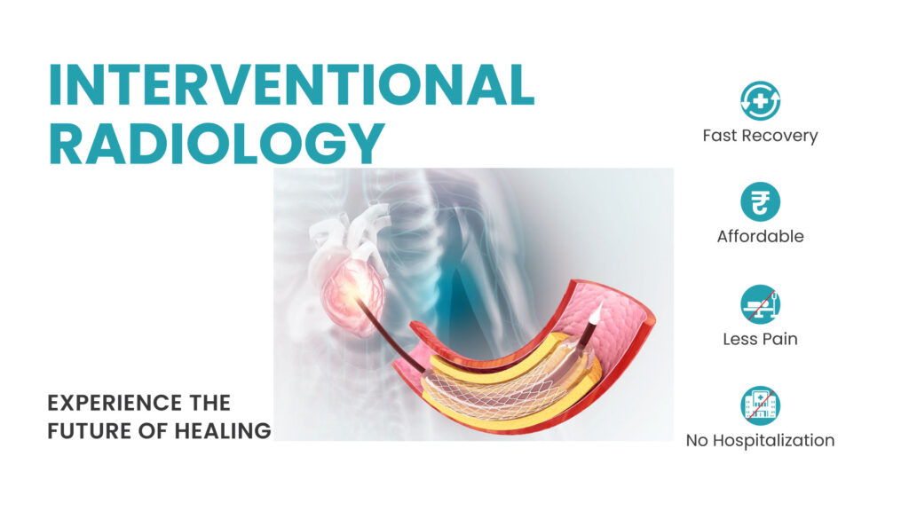 Why choose Interventional Radiology?