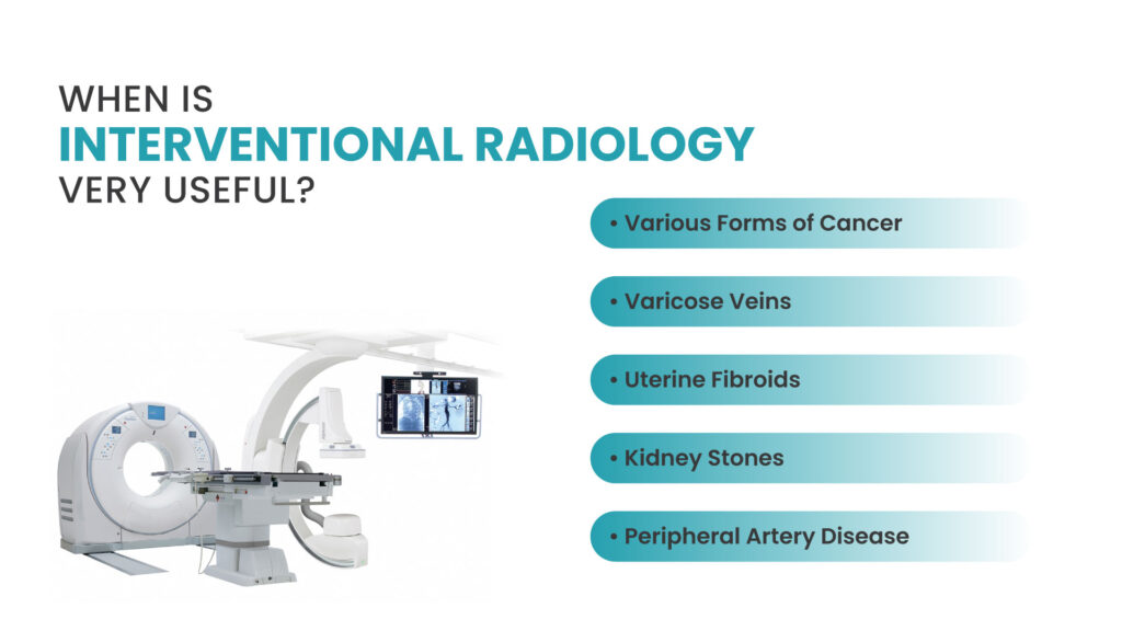 Innovative IR Treatments